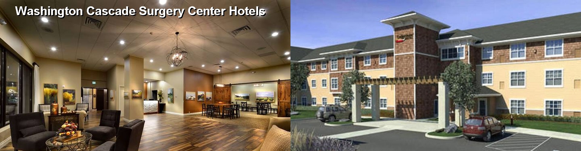 5 Best Hotels near Washington Cascade Surgery Center