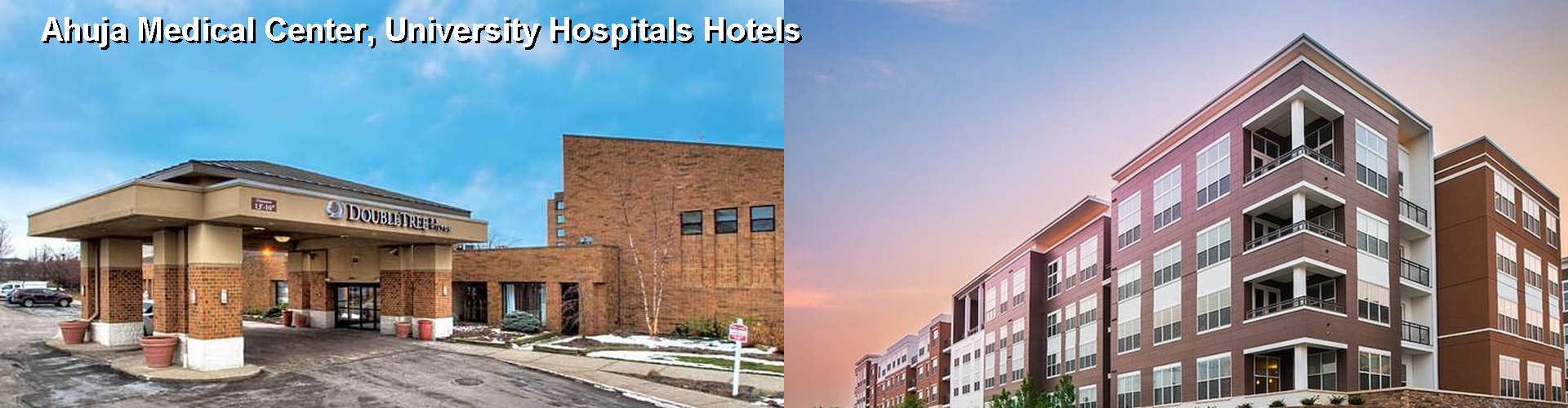 4 Best Hotels near Ahuja Medical Center, University Hospitals