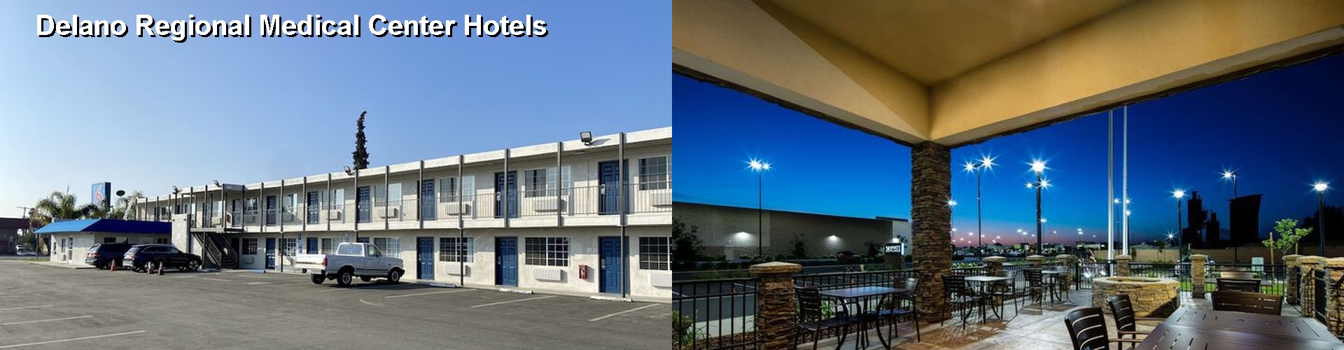 5 Best Hotels near Delano Regional Medical Center