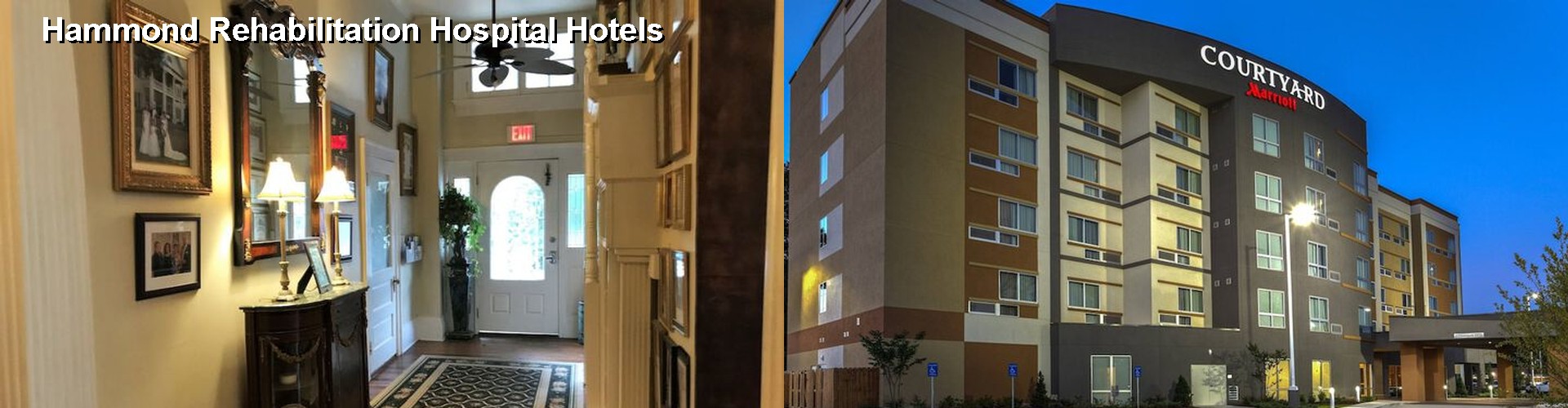 5 Best Hotels near Hammond Rehabilitation Hospital