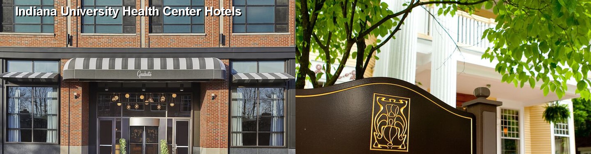 5 Best Hotels near Indiana University Health Center