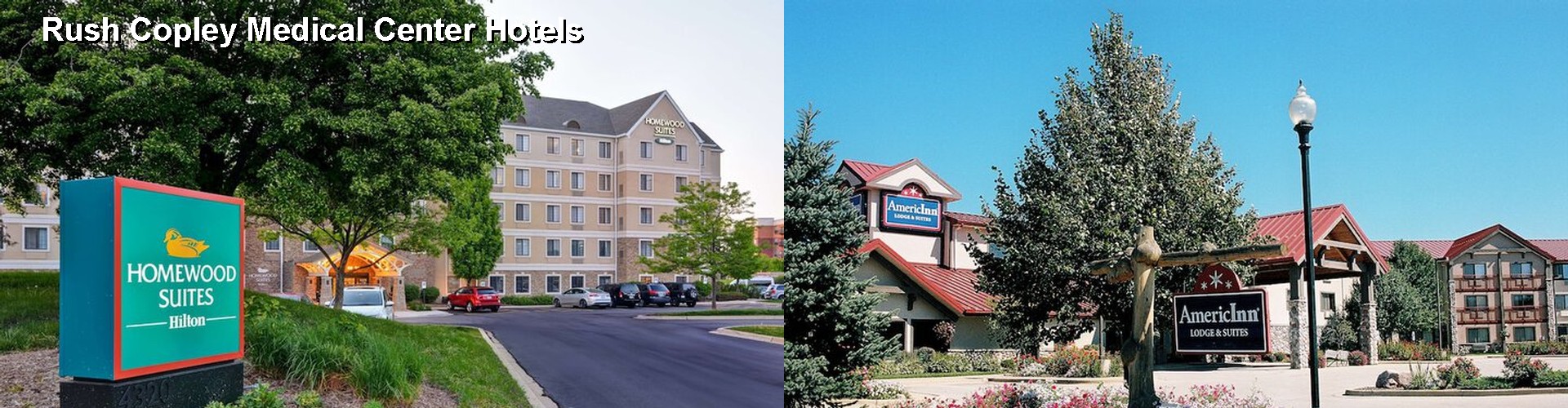 3 Best Hotels near Rush Copley Medical Center